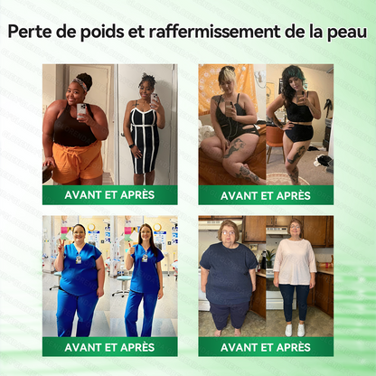 Boutique officielle 🌸 𝒢𝐿𝒪𝑅𝐸𝒩𝒟𝒜® 𝑀𝑜𝓇𝒾𝓃𝑔𝒶 · 𝐵𝑒𝓇𝒷é𝓇𝒾𝓃𝑒 + 𝒩𝒜𝒟+ – 𝒫𝒶𝓉𝒸𝒽 𝑀𝒾𝒸𝓇𝑜𝓃𝑒𝑒𝒹𝓁𝑒 𝒩𝒶𝓃𝑜 𝒜𝓋𝒶𝓃𝒸é 10-𝑒𝓃-1 (1×/jour, résultats visibles en 7 jours) | Obésité, relâchement cutané, apnée du sommeil, articulations, etc.